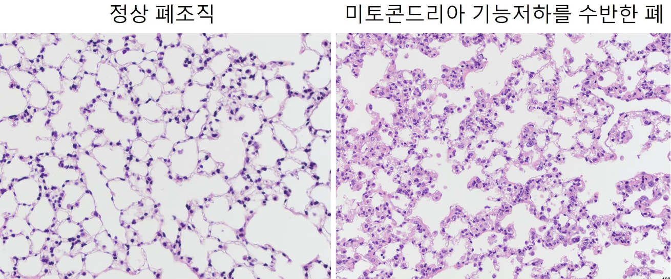 미토콘드리아의