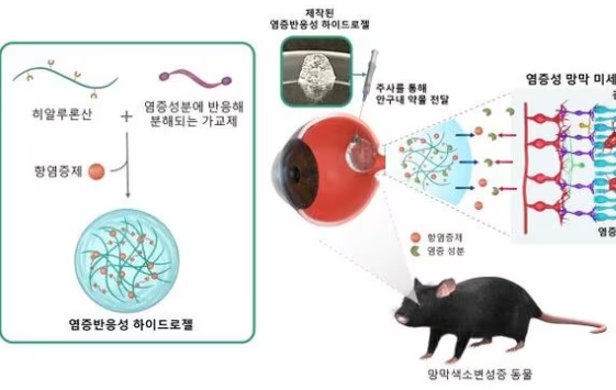 국내 연구진 망막질환