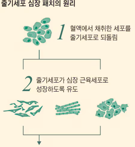 줄기세포 패치로 젊은 근육 재현 심부전 심장 되살렸다